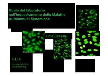 Ruolo del Laboratorio nell'inquadramento delle Malattie Autoimmuni ...