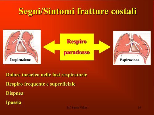 Primo Soccorso parte 2 - Croce Verde Cavallino-Treporti