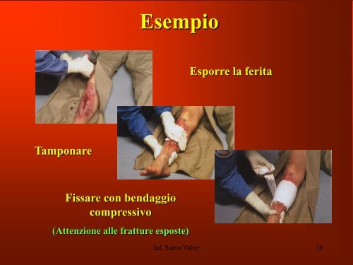 Primo Soccorso parte 2 - Croce Verde Cavallino-Treporti