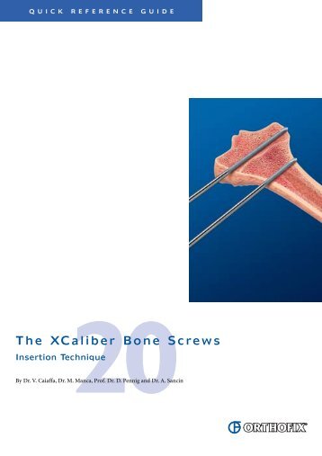 The XCaliber Bone Screws - Orthofix.com