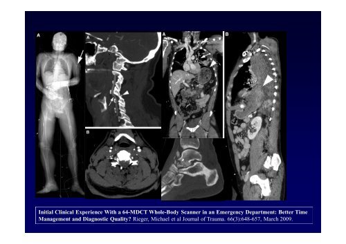 La diagnostica per immagini del trauma maggiore