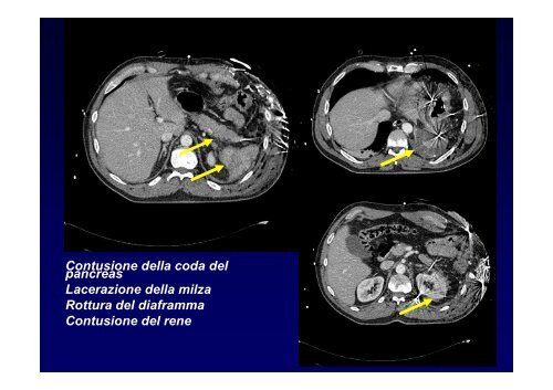 La diagnostica per immagini del trauma maggiore