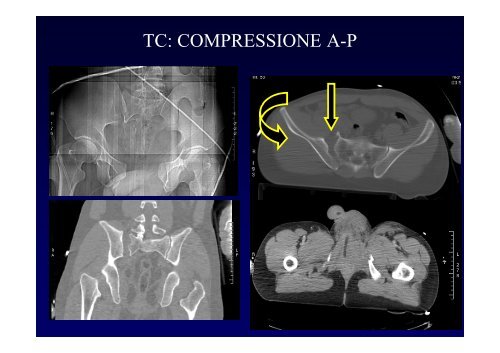 La diagnostica per immagini del trauma maggiore