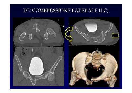 La diagnostica per immagini del trauma maggiore