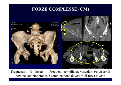 La diagnostica per immagini del trauma maggiore