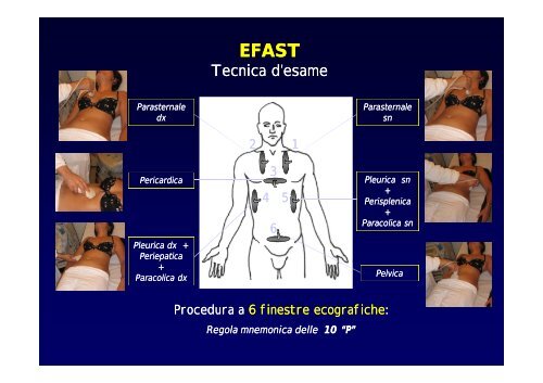 La diagnostica per immagini del trauma maggiore