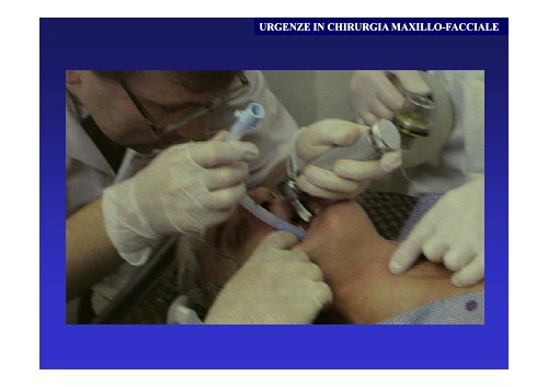 Emergenze in chirurgia maxillo facciale - Supramicrosurgery