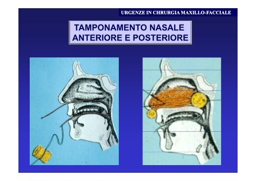 Emergenze in chirurgia maxillo facciale - Supramicrosurgery