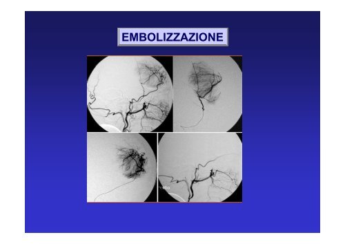 Emergenze in chirurgia maxillo facciale - Supramicrosurgery