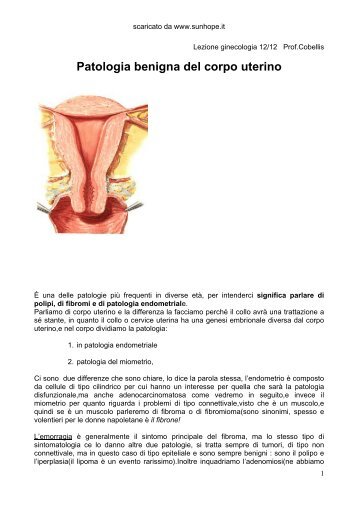 Patologia benigna del corpo uterino - SunHope