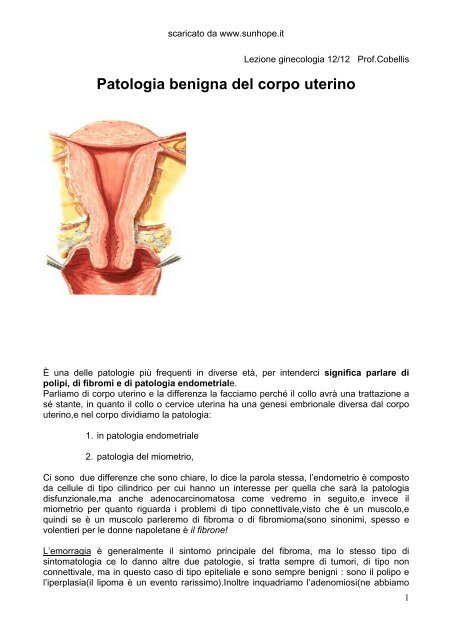 Patologia benigna del corpo uterino - SunHope
