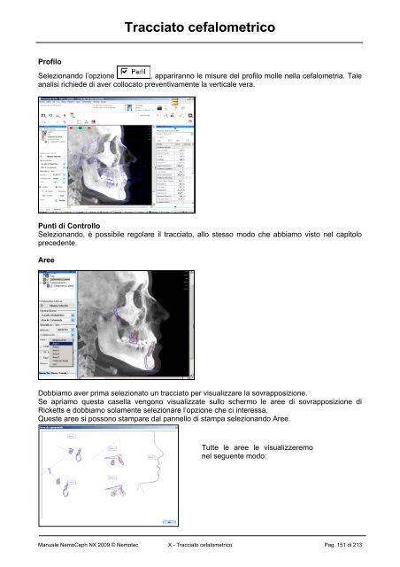 Manuale completo_NemoCeph NX 2009.pdf - Dentaurum Italia