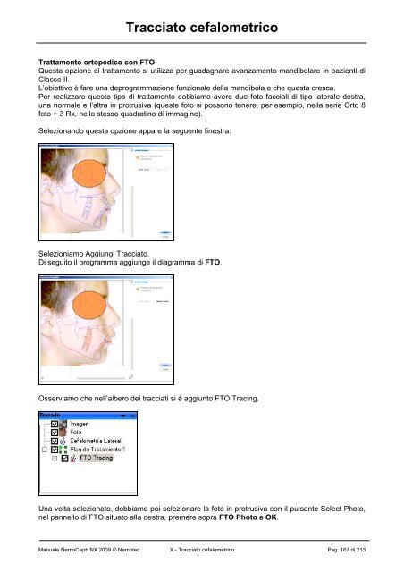 Manuale completo_NemoCeph NX 2009.pdf - Dentaurum Italia