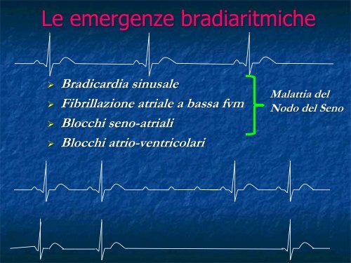 Advanced Cardiac Life Support Parte III: Le Emergenze Bradiaritmiche