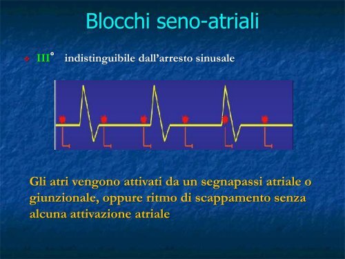 Advanced Cardiac Life Support Parte III: Le Emergenze Bradiaritmiche