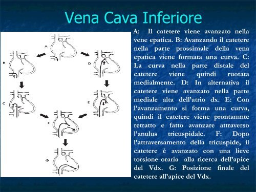 Advanced Cardiac Life Support Parte III: Le Emergenze Bradiaritmiche