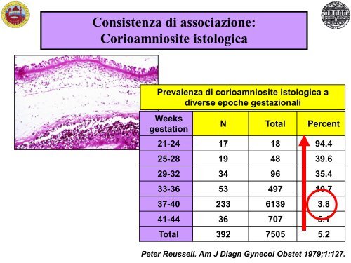 Possibili eziologie del parto pretermine spontaneo - Associazione ...