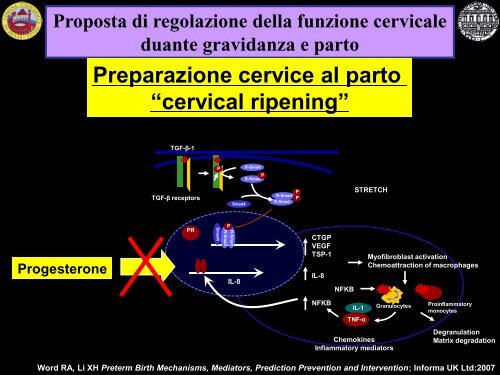 Possibili eziologie del parto pretermine spontaneo - Associazione ...