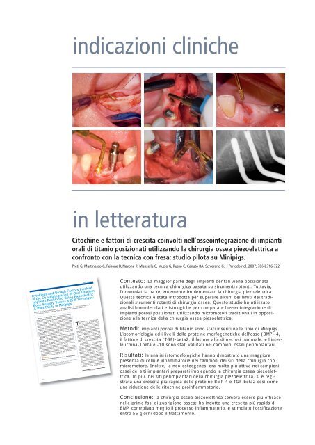 Protocollo clinico per la preparazione del sito implantare ... - Mectron