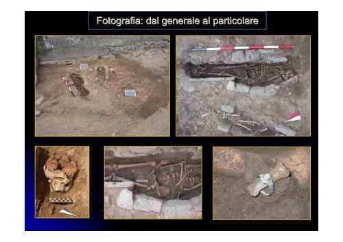 Archeologia Funeraria - Paleopatologia