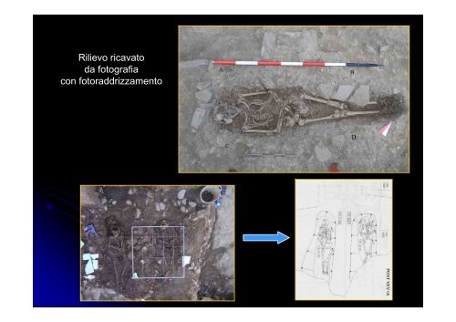 Archeologia Funeraria - Paleopatologia