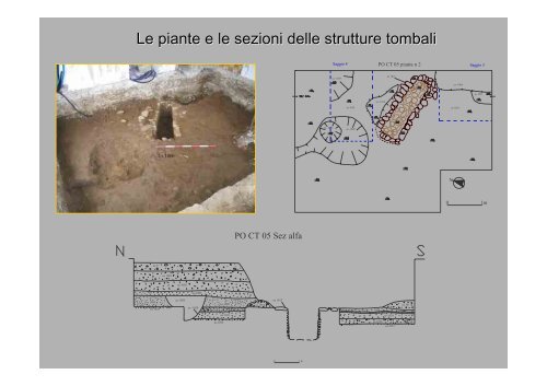 Archeologia Funeraria - Paleopatologia