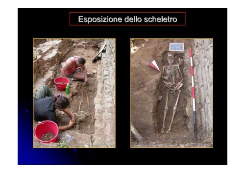 Archeologia Funeraria - Paleopatologia