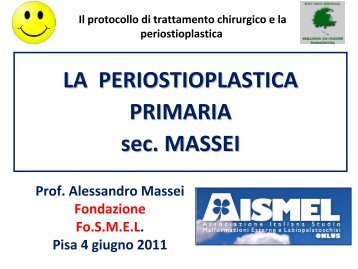 PERIOSTIOPLASTICA PRIMARIA SEC. MASSEI - Labiopalatoschisi