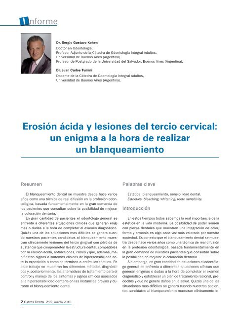 Erosión ácida y lesiones del tercio cervical - Dentsply