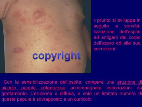patologia da artropodi 2012 - Corso di laurea in tecniche della ...