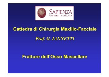 frattura del mascellare - Supramicrosurgery