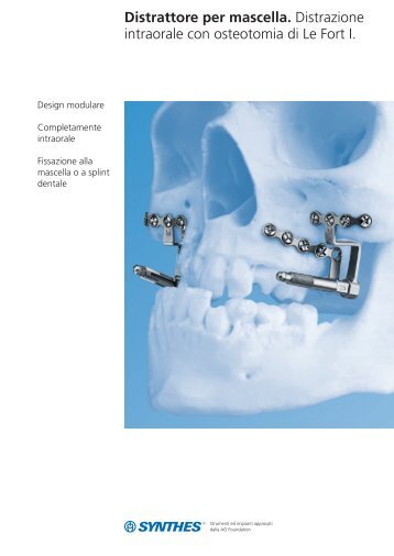 distrattore per mascella brossura - Synthes