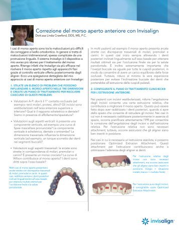 Correzione del morso aperto anteriore con Invisalign - Aligntech ...