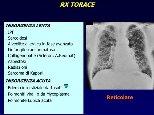 INTERSTIZIOPATIE POLMONARI - laprimapietra - Altervista