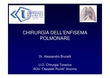 CHIRURGIA DELL'ENFISEMA POLMONARE - Dr. Alessandro Brunelli