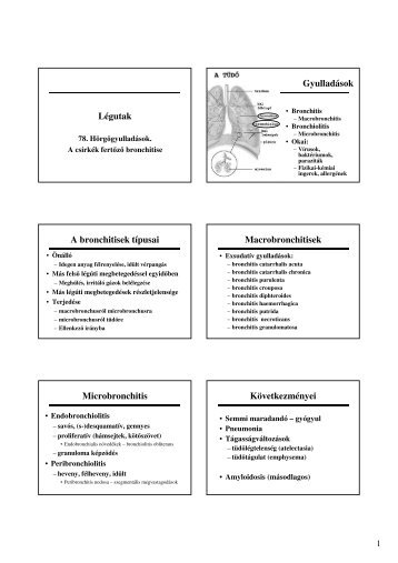 Légutak Gyulladások A bronchitisek típusai Macrobronchitisek ...