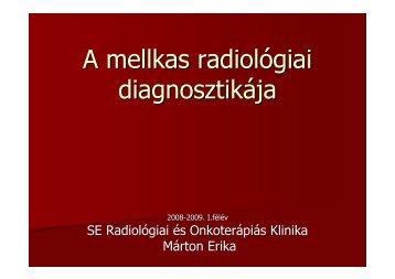 A mellkas radiológiai diagnosztikája