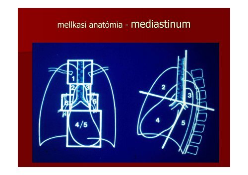 A mellkas radiológiai diagnosztikája