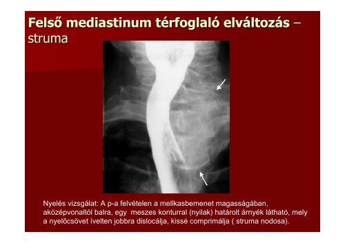 A mellkas radiológiai diagnosztikája