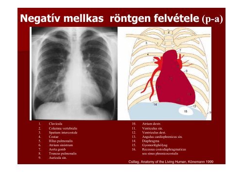 A mellkas radiológiai diagnosztikája