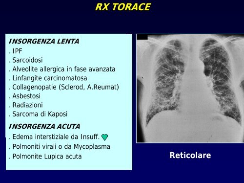 Le pneumopatie diffuse - vitarubata