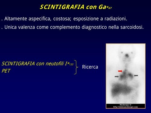 Le pneumopatie diffuse - vitarubata