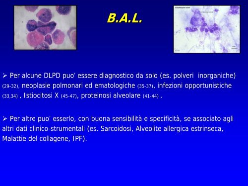 Le pneumopatie diffuse - vitarubata