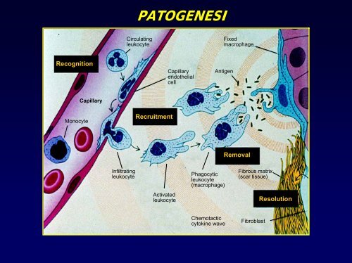 Le pneumopatie diffuse - vitarubata