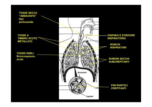 3 tosse ed emottisi - Facoltà di Medicina e Chirurgia - Università ...