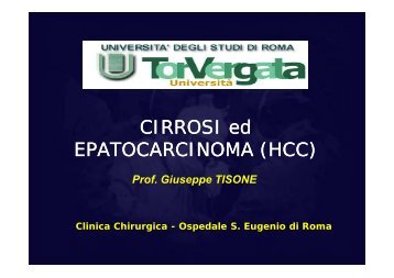 CIRROSI ed EPATOCARCINOMA (HCC)