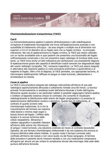 Chemioembolizzazione transarteriosa (TACE) - Ospedale Sacro ...