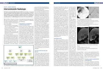 "Minimal- invasive Therapie des Leberkrebs" von Prof. Pereira