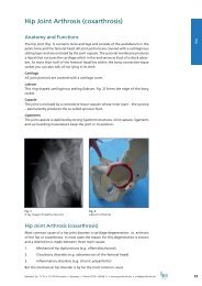 Hip Joint Arthrosis (coxarthrosis) - Arcus Sportklinik