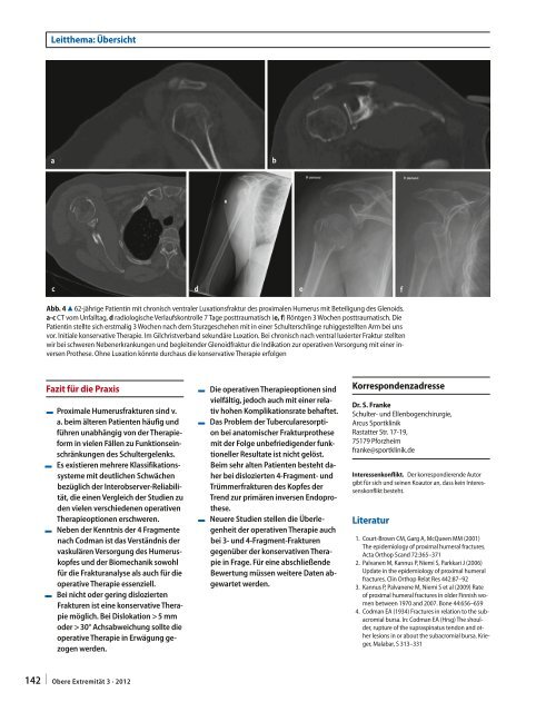 Die proximale Humerusfraktur - Arcus Sportklinik